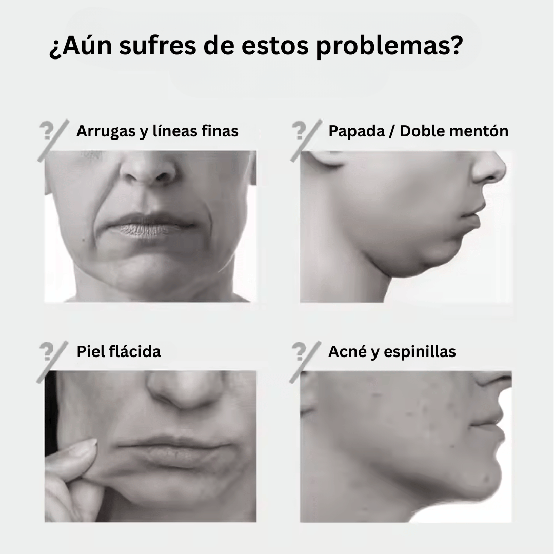 Dispositivo Facial EMS 4 en 1 - Lifting Sin Dolor