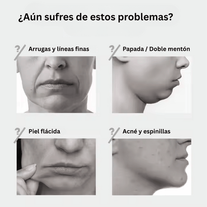 Dispositivo Facial EMS 4 en 1 - Lifting Sin Dolor