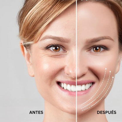Dispositivo Facial EMS 4 en 1 - Lifting Sin Dolor