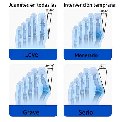 Corrector de Juanetes Ajustable con Silicona - Alivio del Dolor